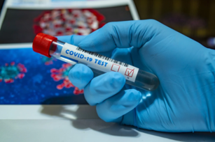 Vyhlásili jsme sbírku na zajištění testů na koronavirus – pro nás i naše klienty