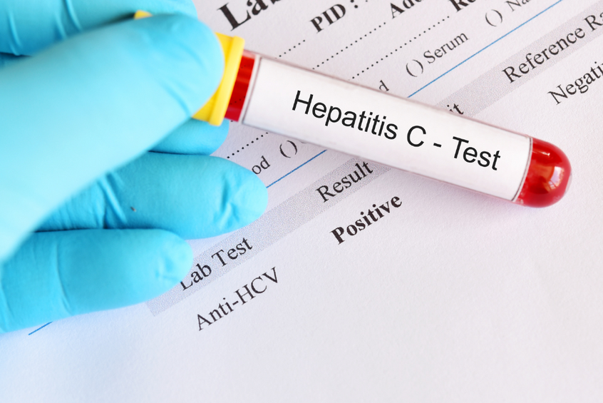 Hepatitida C: klíčové je včasné odhalení. Pomáhají terénní pracovníci