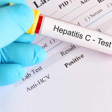 Hepatitida C: klíčové je včasné odhalení. Pomáhají terénní pracovníci